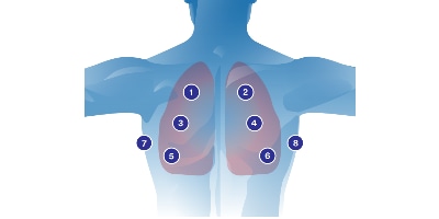 Schéma d’auscultation pulmonaire
